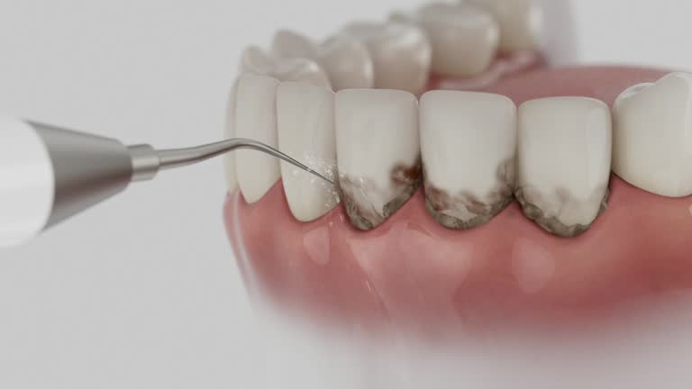 Reliable Dental Implants contractor in Newberry, FL by Smile Center Dentistry